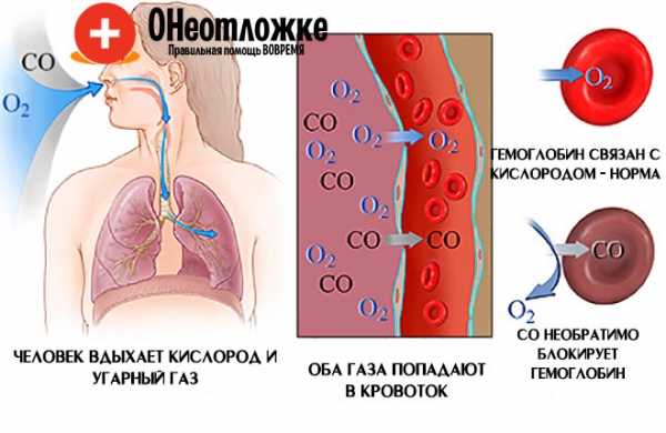 После попадания в организм. Патогенез отравления угарным газом. Токсическое действие угарного газа. Механизм действия угарного газа на организм. Отравление окисью углерода патогенез.